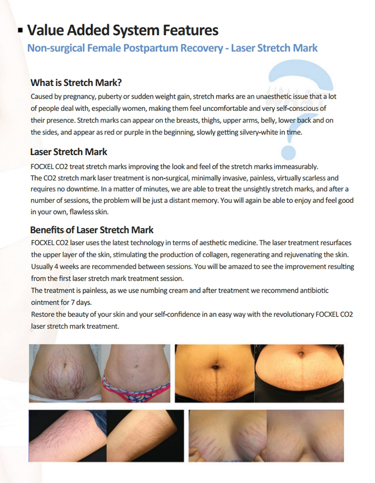 HOT Dermatology Aesthetic vaginal tigthening fractional co2 laser equipment