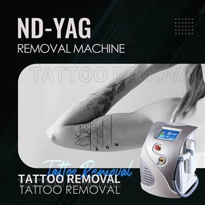 ND: mesin penyingkiran tatu laser 1064nm yag laser